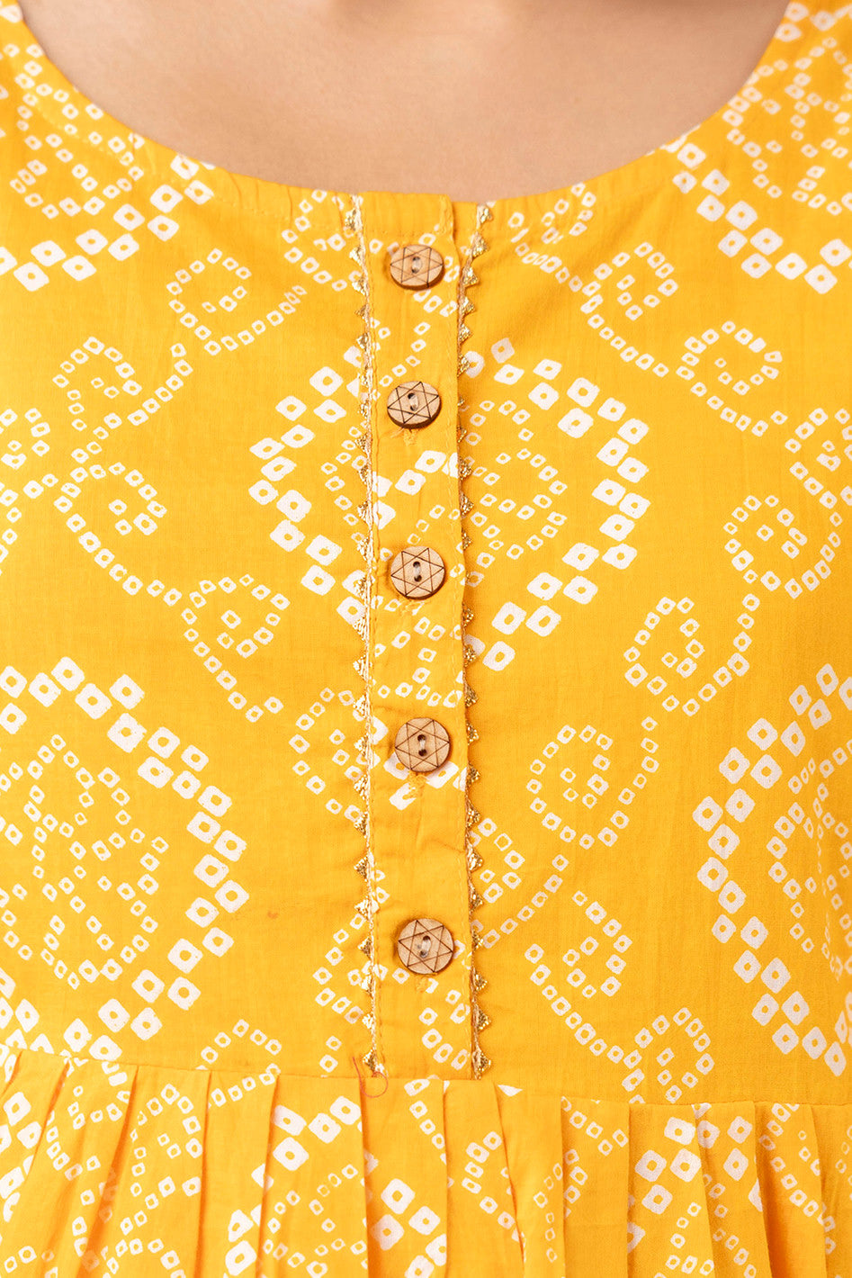 HENAL PK52 Yellow maternity and nursing kurta: close-up of round neckline, front button trim and white motifs.